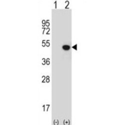 JmjC Domain-Containing Protein 5 (JMJD5) Antibody