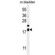 F162A Antibody