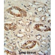 Protein Phosphatase, Mg2+/Mn2+ Dependent 1L (PPM1L) Antibody