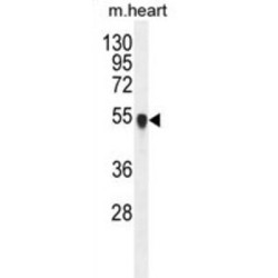 Protein Phosphatase, Mg2+/Mn2+ Dependent 1L (PPM1L) Antibody