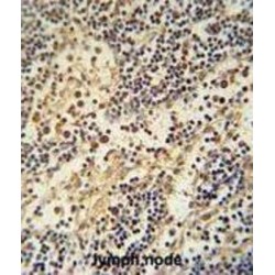 HemK Methyltransferase Family Member 1 (HEMK1) Antibody