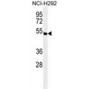 Protein ABHD8 (ABHD8) Antibody