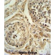 abx026038