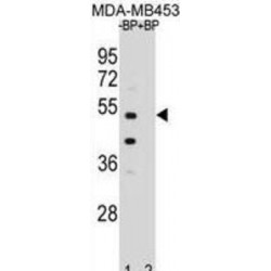 WD Repeat-Containing Protein 51B (WDR51B) Antibody