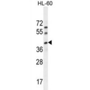 C17orf59 Antibody