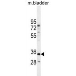 C17orf59 Antibody