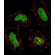 Histone Deacetylase 1 (HDAC1) Antibody