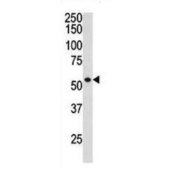 Histone Deacetylase 1 (HDAC1) Antibody