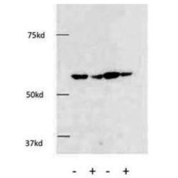 Histone Deacetylase 1 (HDAC1) Antibody