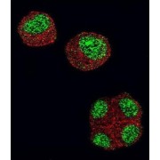 Histone Deacetylase 1 (HDAC1) Antibody