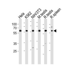 Histone Deacetylase 1 (HDAC1) Antibody