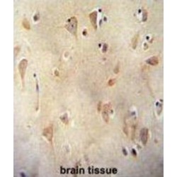 Leucine-Rich Repeat-Containing Protein 40 (LRC40) Antibody