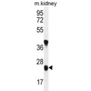 Protein Unc-119 Homolog B (U119B) Antibody