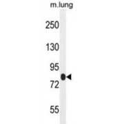 Tetratricopeptide Repeat Protein 30B (TTC30B) Antibody