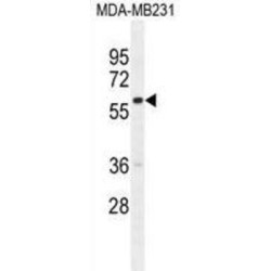 Guanine Nucleotide Binding Protein Like 3 (Nucleolar) Like (GNL3L) Antibody