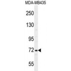 S1 RNA Binding Domain 1 (SRBD1) Antibody