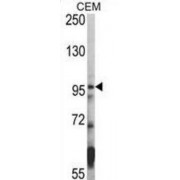 Histone Deacetylase 7 (HDAC7) Antibody