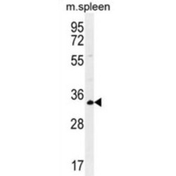 Aldolase C, Fructose Bisphosphate (ALDOC) Antibody