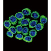abx026084