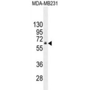 Hepatocyte Nuclear Factor 1-Beta (HNF1B) Antibody