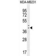 Interferon Regulatory Factor 1 (IRF1) Antibody