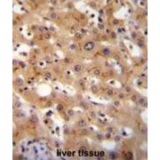 gamma-Glutamyl Carboxylase (GGCX) Antibody