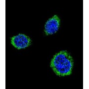 Glutamate Decarboxylase 2 (GAD2) Antibody