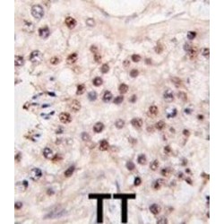 Histone Deacetylase 11 (HDAC11) Antibody