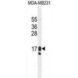 GCDFP-15 Antibody