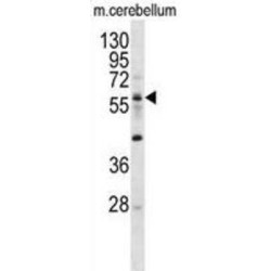 Elongator Acetyltransferase Complex Subunit 3 (ELP3) Antibody