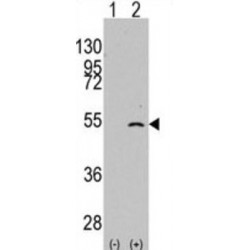 Elongator Acetyltransferase Complex Subunit 3 (ELP3) Antibody