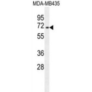 Splicing Factor, Arginine/serine-Rich 17A (SFRS17A) Antibody