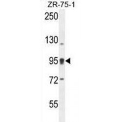 Arf-GAP With Coiled-Coil, ANK Repeat And PH Domain Containing Protein 1 (ACAP1) Antibody