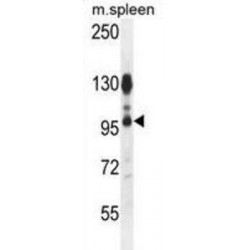 Arf-GAP With Coiled-Coil, ANK Repeat And PH Domain Containing Protein 1 (ACAP1) Antibody