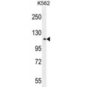 Tudor Domain-Containing Protein 1 (TDRD1) Antibody