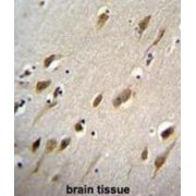 HARB1 Antibody