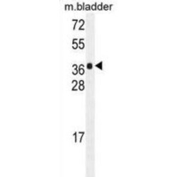 HARB1 Antibody