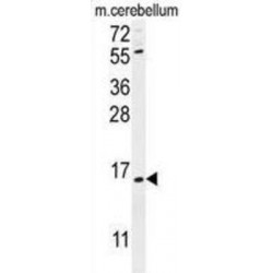 Ankyrin Repeat Domain-Containing Protein 39 (ANR39) Antibody