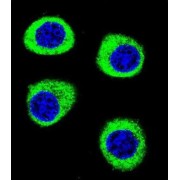 Cleavage And Polyadenylation-Specific Factor 3-Like Protein (CPSF3L) Antibody