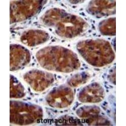 Cleavage And Polyadenylation-Specific Factor 3-Like Protein (CPSF3L) Antibody