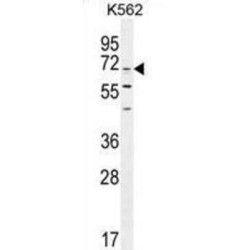 Cleavage And Polyadenylation-Specific Factor 3-Like Protein (CPSF3L) Antibody