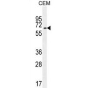 WB analysis of CEM cell line lysates, using UNCX Antibody.