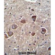 Phospholipid Phosphatase 4 (PPAPDC1A) Antibody