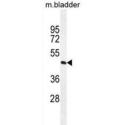 Phospholipid Phosphatase 4 (PPAPDC1A) Antibody