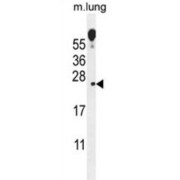 ECOP Antibody
