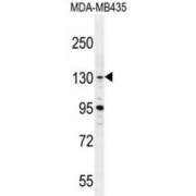 Glioma Tumor Suppressor Candidate Region Gene 1 Protein (GLTSCR1) Antibody