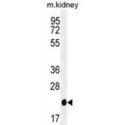 Glutathione Peroxidase 3 (GPX3) Antibody