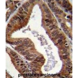 ETS1-Associated Protein II (EAPII) Antibody