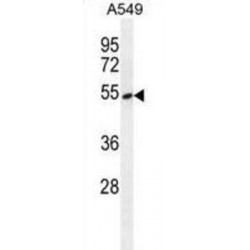 ETS1-Associated Protein II (EAPII) Antibody