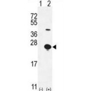 WB analysis of 293 cell lysates (1) non-transfected, and (2) transiently transfected with the EPGN gene.